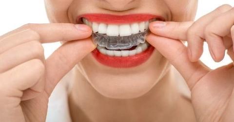 wp content/uploads///aligners